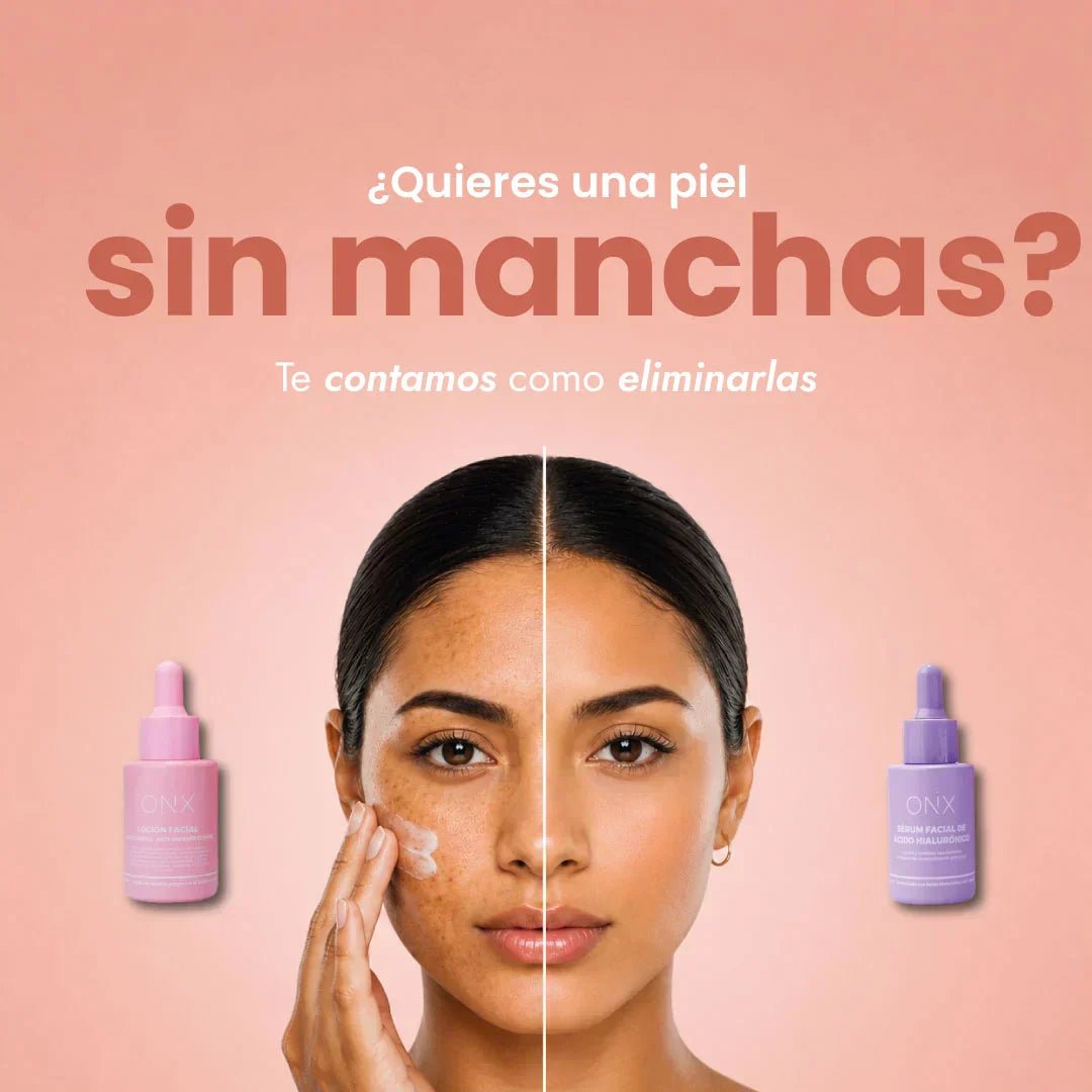¿Cómo quitar manchas de la piel? Guía completa para lograr un tono uniforme y luminoso - Onix Skincare