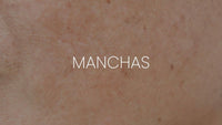 MANCHAS