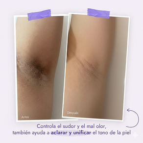 DÚO CORPORAL ACLARANTE + PRODUCTO SORPRESA GRATIS | ACLARA EL TONO DE TU PIEL - Hover Image