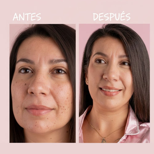Loción Facial Unificadora | Tónico Despigmentante + PRODUCTO SORPRESA GRATIS - 2