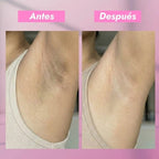 DÚO CORPORAL ACLARANTE | ACLARA EL TONO DE TU CUERPO - Onix Skincare