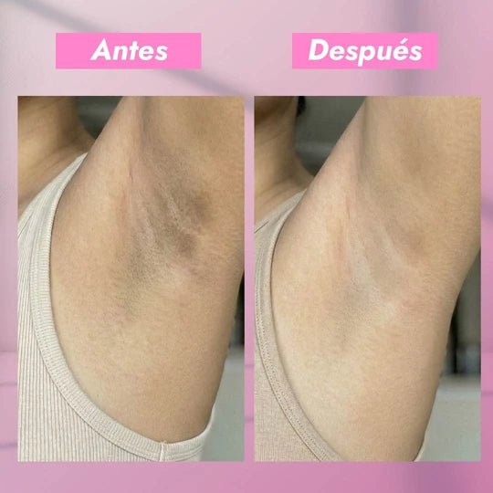 DÚO CORPORAL ACLARANTE | ACLARA EL TONO DE TU CUERPO - Onix Skincare